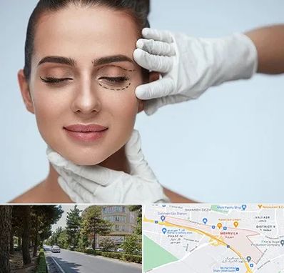 عمل پف چشم در مهرویلا کرج