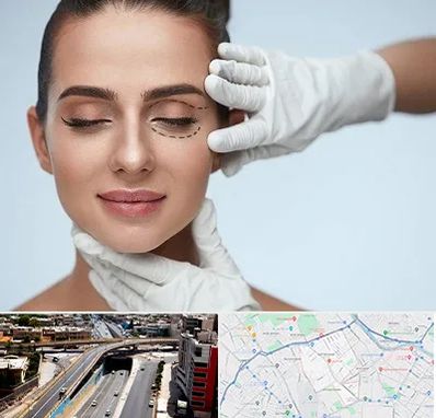 عمل پف چشم در ستارخان شیراز