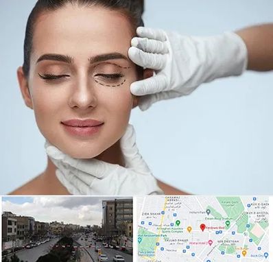 عمل پف چشم در بلوار فردوسی مشهد