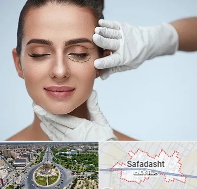 عمل پف چشم در صفادشت