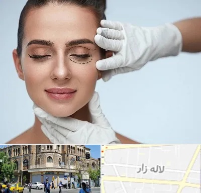 عمل پف چشم در لاله زار