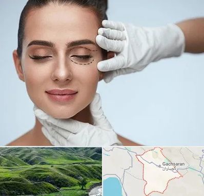 عمل پف چشم در گچساران