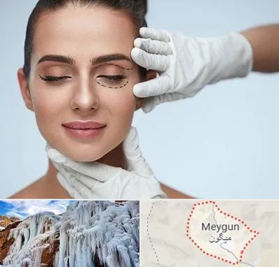 عمل پف چشم در میگون