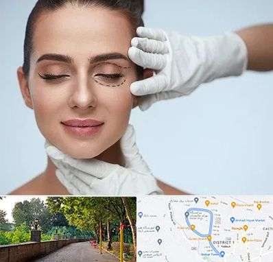 عمل پف چشم در فلکه گاز رشت