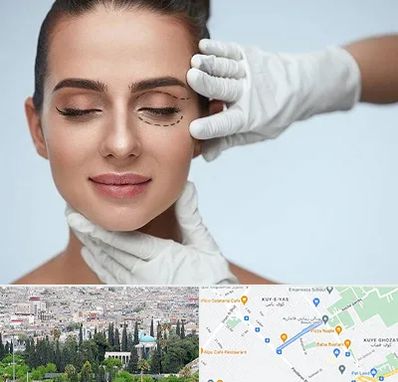 عمل پف چشم در محلاتی شیراز