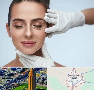 عمل پف چشم در گنبد کاووس