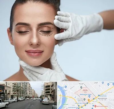 عمل پف چشم در زیتون کارمندی اهواز