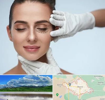 عمل پف چشم در مرند