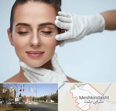 عمل پف چشم در مشکین دشت