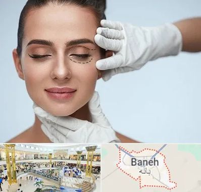 عمل پف چشم در بانه