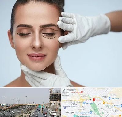 عمل پف چشم در بلوار توس مشهد