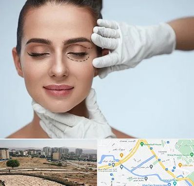 عمل پف چشم در کوی وحدت شیراز