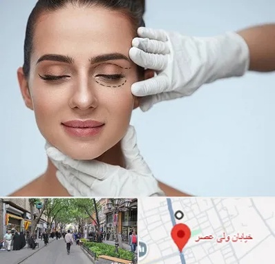 عمل پف چشم در ولیعصر شهریار