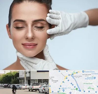 عمل پف چشم در قدوسی شرقی شیراز