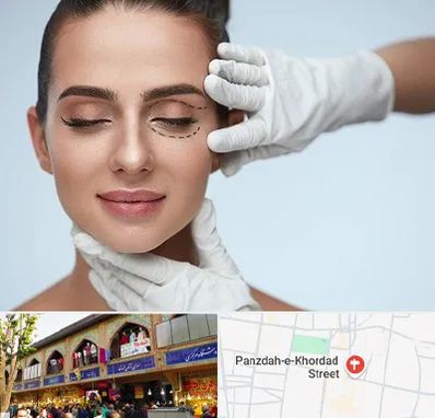 عمل پف چشم در 15 خرداد