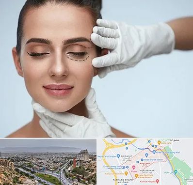 عمل پف چشم در معالی آباد شیراز