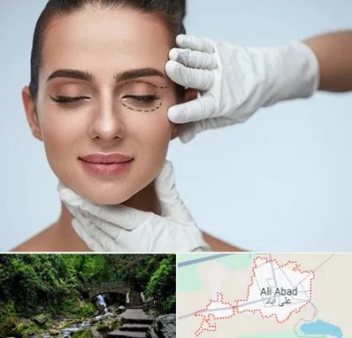 عمل پف چشم در علی آباد کتول