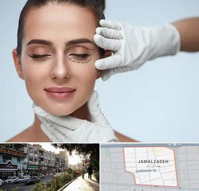 عمل پف چشم در خیابان جمالزاده