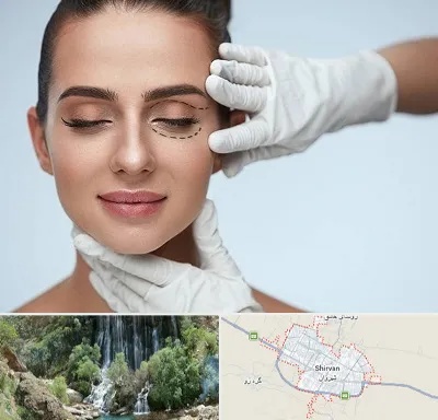 عمل پف چشم در شیروان