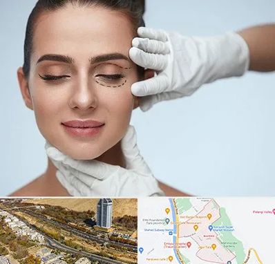 عمل پف چشم در خیابان نیایش شیراز