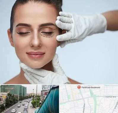 عمل پف چشم در بلوار فرحزادی