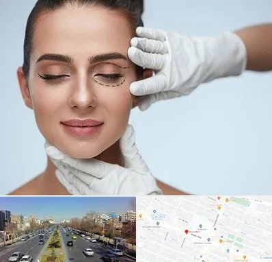 عمل پف چشم در بلوار معلم مشهد