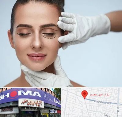 عمل پف چشم در امین حضور