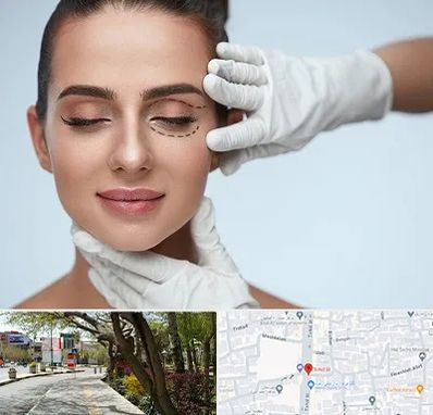 عمل پف چشم در خیابان توحید اصفهان