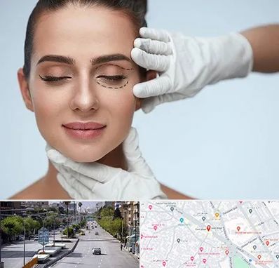 عمل پف چشم در خیابان زند شیراز