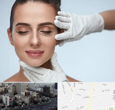 عمل پف چشم در زرتشت