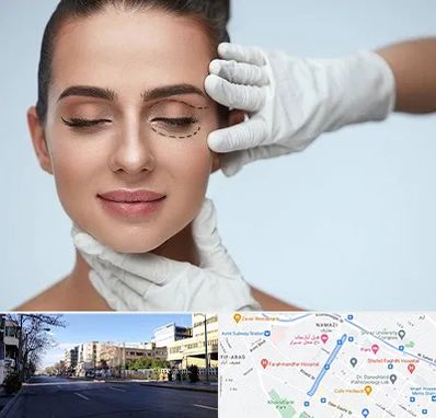 عمل پف چشم در خیابان ملاصدرا شیراز