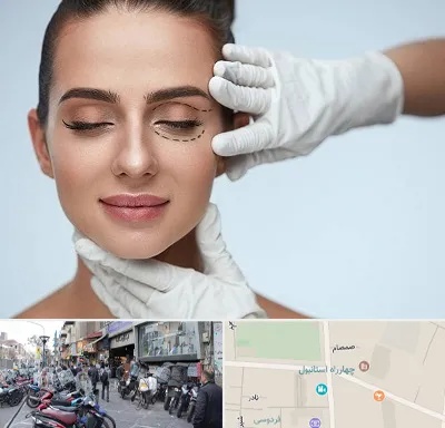 عمل پف چشم در چهارراه استانبول