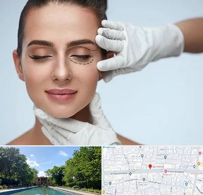 عمل پف چشم در هشت بهشت اصفهان