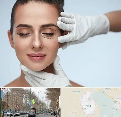 عمل پف چشم در نظرآباد کرج