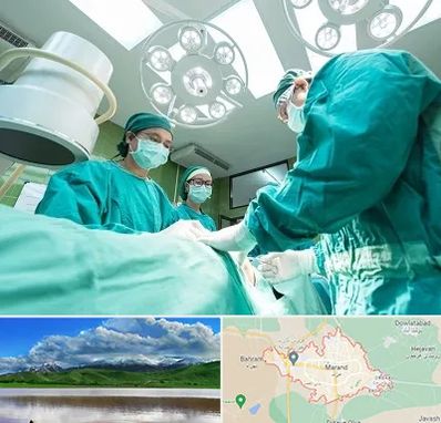 عمل تخلیه سینه در مرند