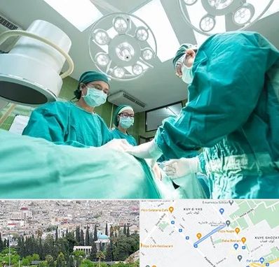 عمل تخلیه سینه در محلاتی شیراز