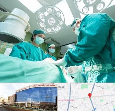 عمل تخلیه سینه در نصف راه تبریز