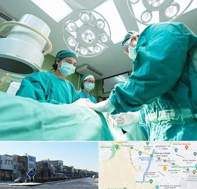 عمل تخلیه سینه در شریعتی مشهد