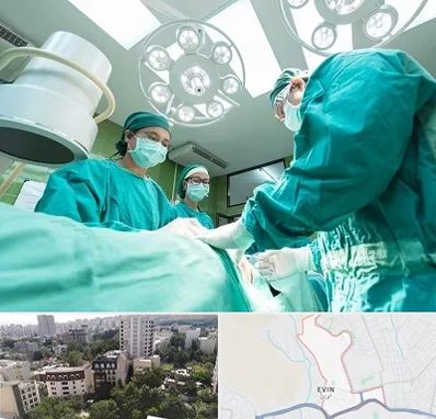 عمل تخلیه سینه در اوین