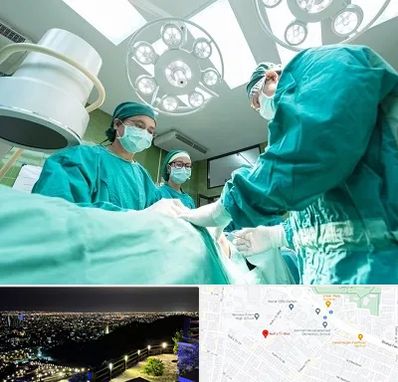 عمل تخلیه سینه در هفت تیر مشهد