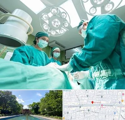 عمل تخلیه سینه در هشت بهشت اصفهان