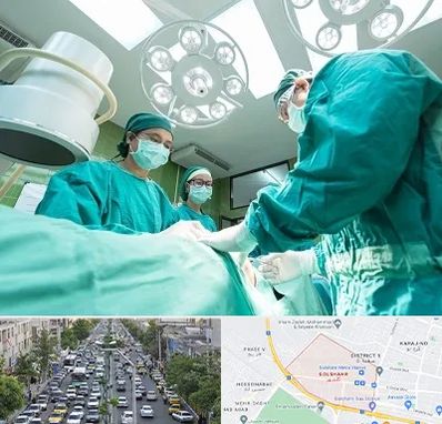 عمل تخلیه سینه در گلشهر کرج