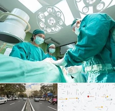 عمل تخلیه سینه در دولت