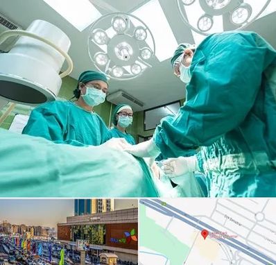 عمل تخلیه سینه در لاله پارک تبریز