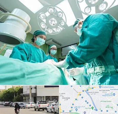 عمل تخلیه سینه در قدوسی شرقی شیراز