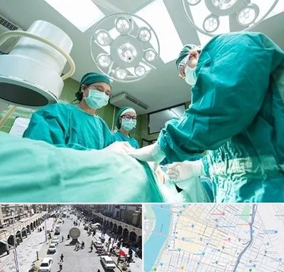 عمل تخلیه سینه در نادری اهواز