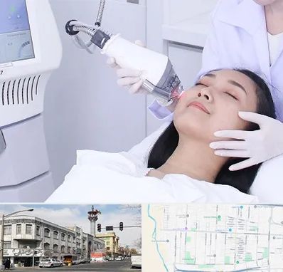 وایتنینگ در 17شهریور