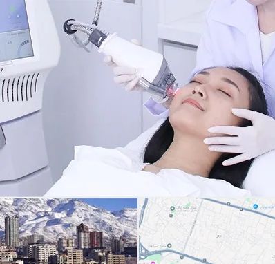 وایتنینگ در ازگل