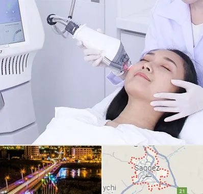 وایتنینگ در سقز