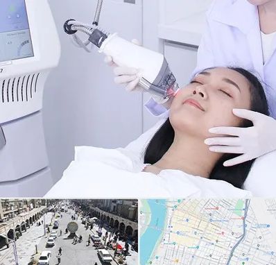 وایتنینگ در نادری اهواز